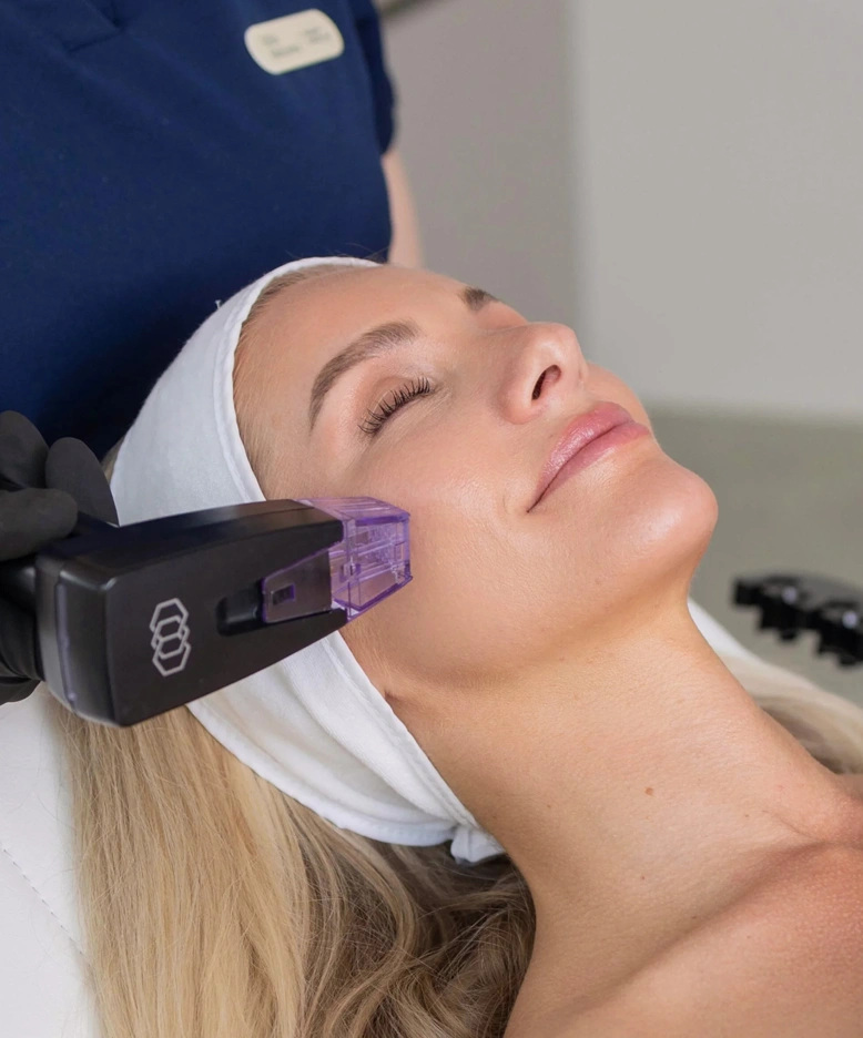 Beneficios del tratamiento Morpheus8