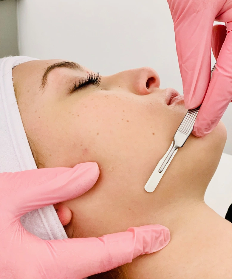 Beneficios del tratamiento facial