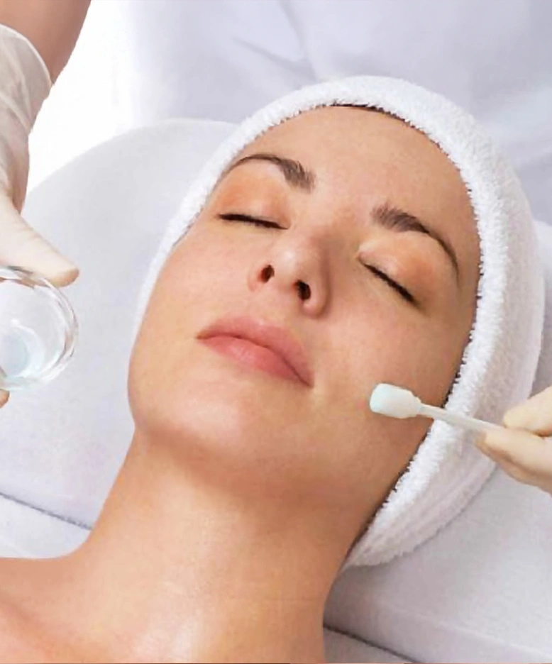 Cómo funciona un peeling quimico