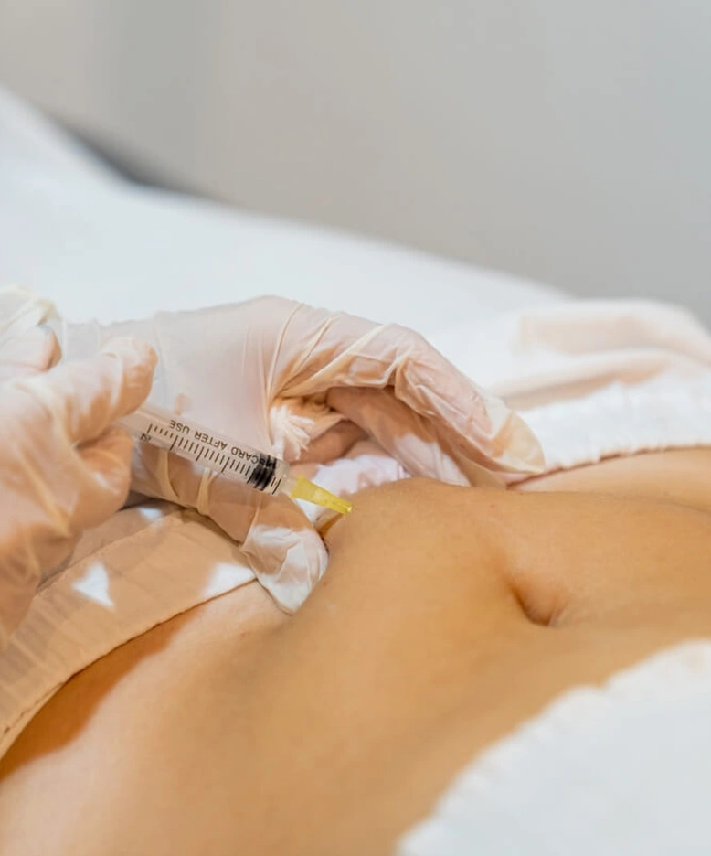 Cómo se aplica la mesoterapia