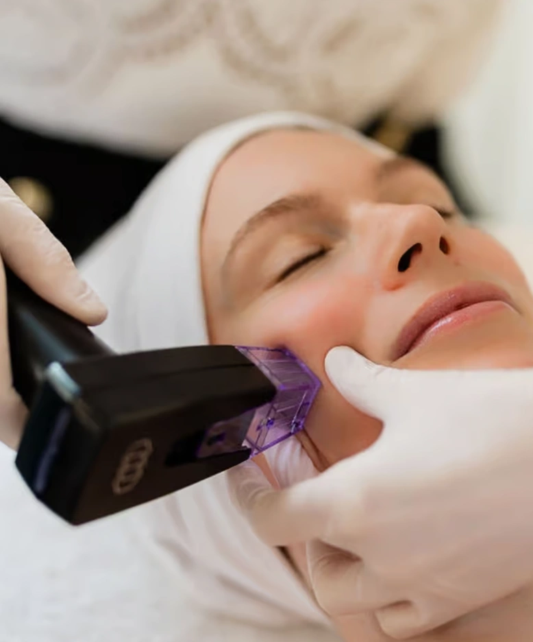 Morpheus 8 Facial