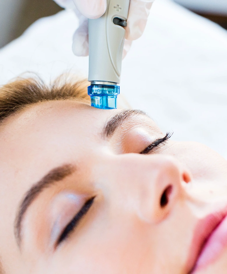 Qué Hydrafacial