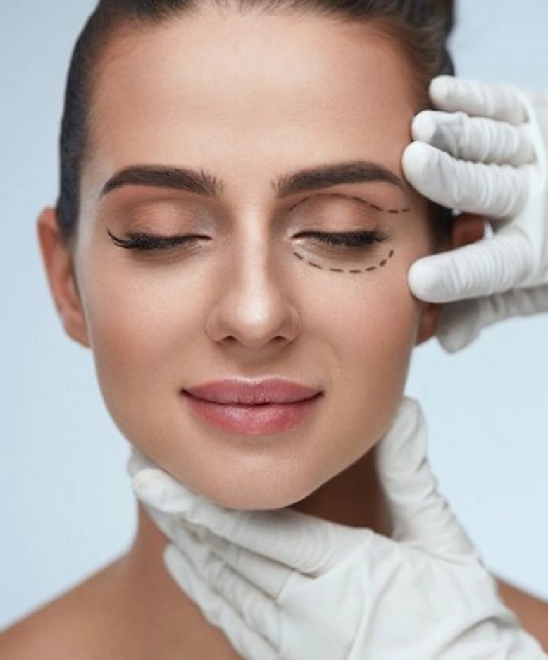 Tratamiento para eliminar ojeras Marbella