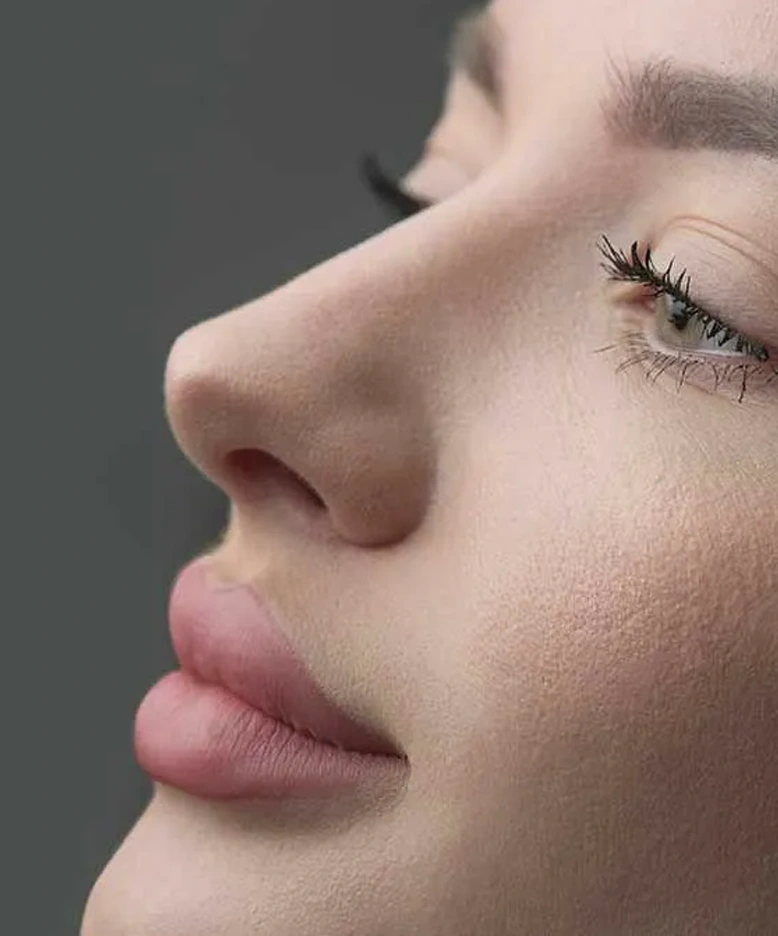 Ventajas de la rinomodelación vs rinoplastia tradicional